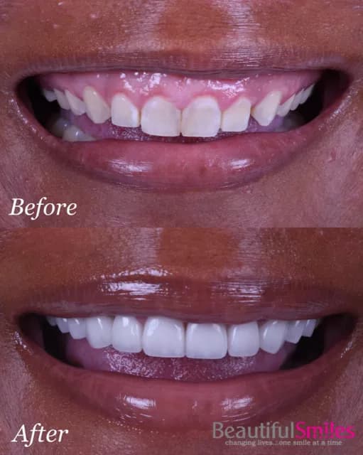 Smile transformation
