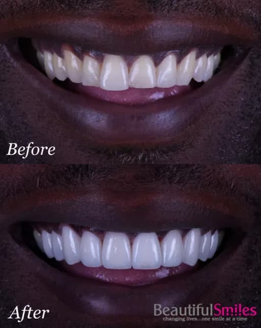 Smile transformation