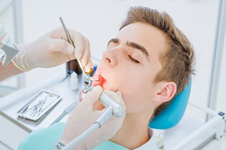 Restoring Teeth With Dental Fillings