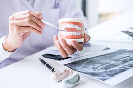 Types of Dentures