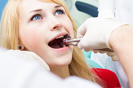How is a tooth extraction performed?